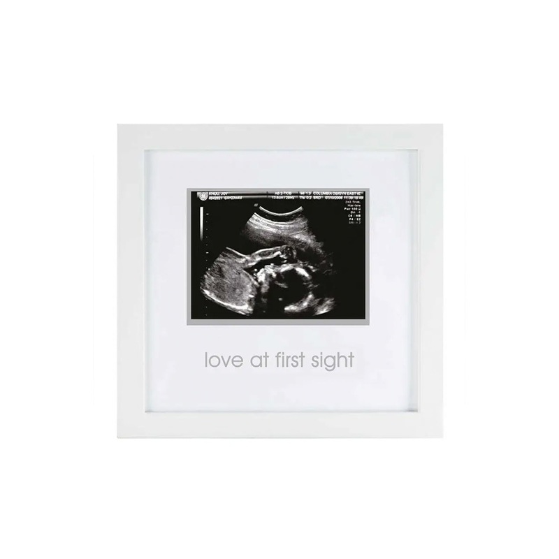 Pearhead Love At First Sight Sonogram Frame